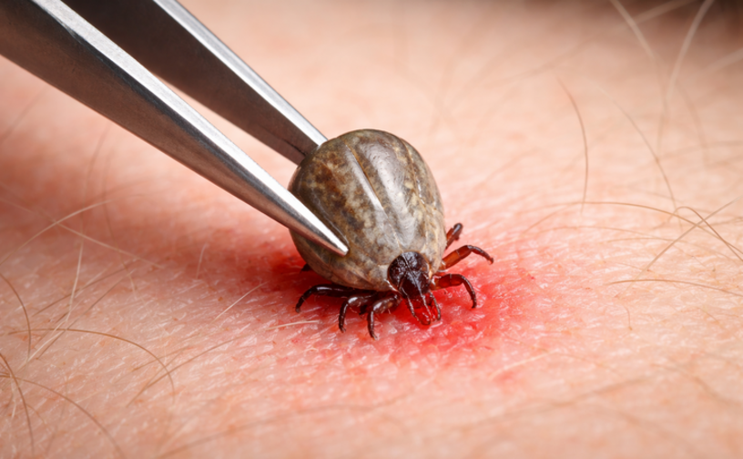 Клещи проснулись: первые укусы уже зафиксированы — как защитить себя и детей.